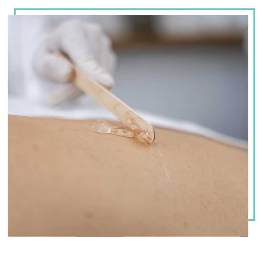 Gel-Vorbereitung-Behandlung