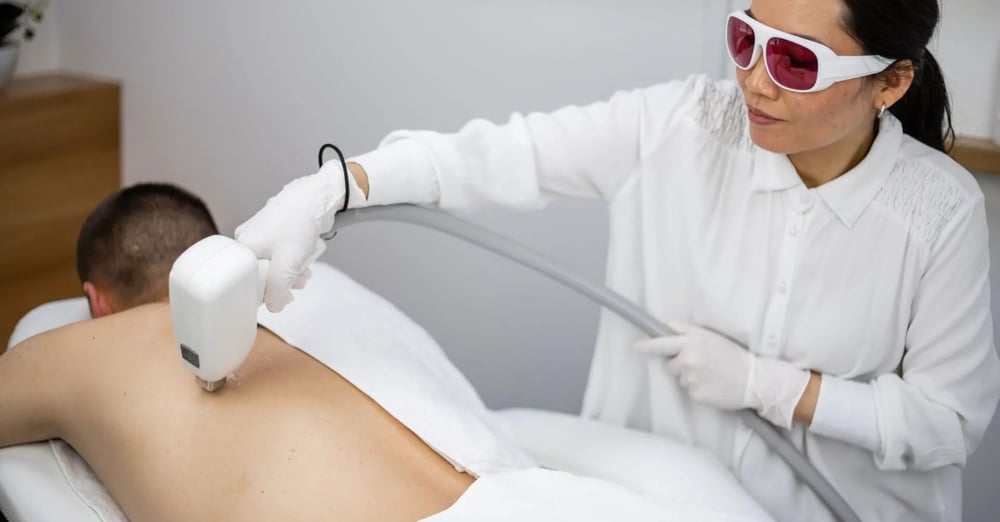 Mann bei Laserbehandlung seines Rückens.
