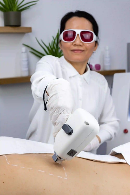 Mitarbeiterin lasert Rücken